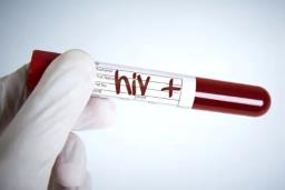 झन्डै २ लाखमा परीक्षण गर्दा १ हजार ५ सय भन्दा बढीमा एचआईभी संक्रमण
