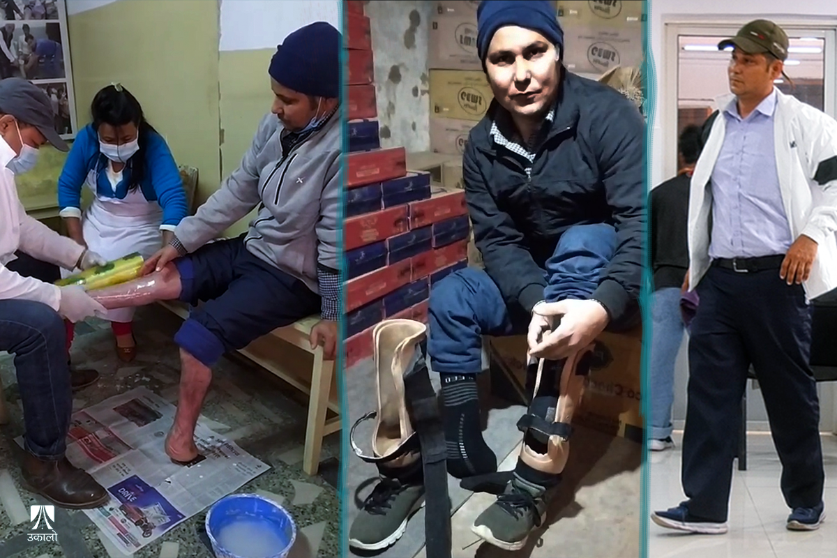 भुंग्रोले खाएका खुट्टा सग्लाझैँ भएपछि आत्मबल टेकेर उभिएका सन्तोष (भिडियोसहित)