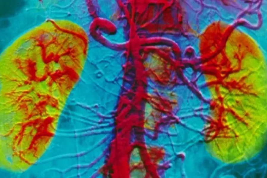 अस्वस्थ जीवनशैलीले बढाउँदै नसर्ने रोगको जोखिम