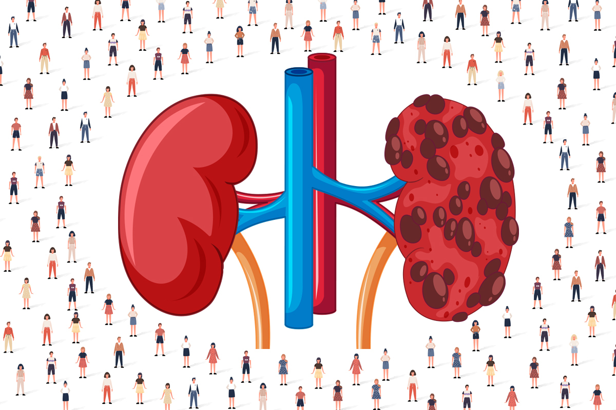मिर्गौला दिनेमा महिलाको संख्या दोब्बर, लिने अधिकांश पुरुष