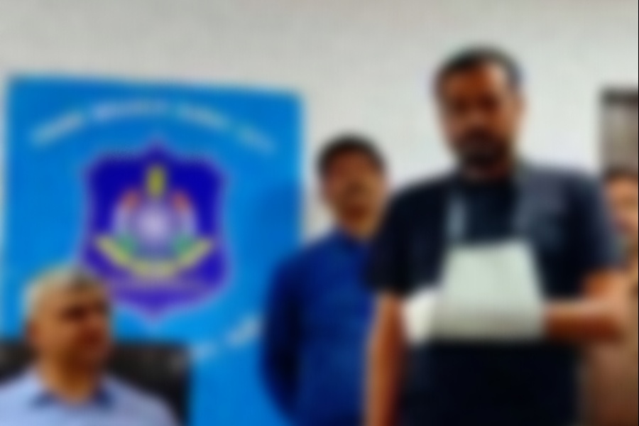 जागिर छाड्छु भन्न नसकेर कर्मचारीले काटे आफ्नै हातका औँला