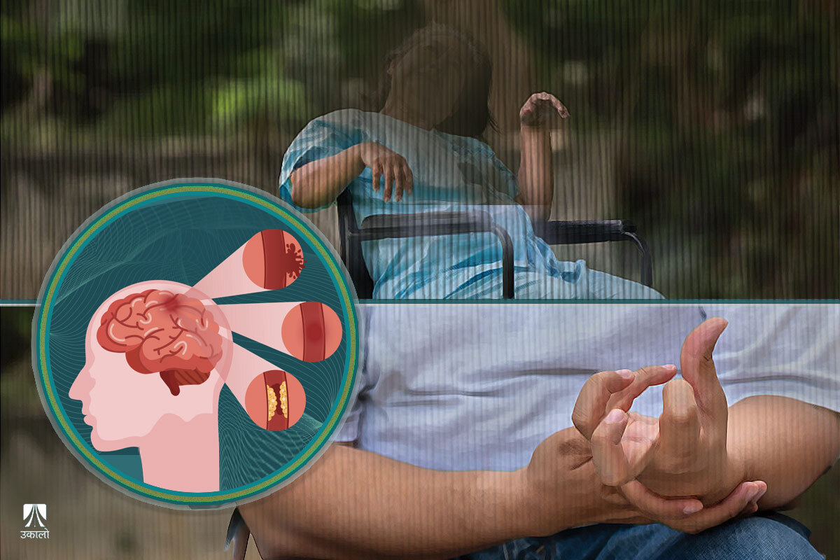 मस्तिष्कघातका बिरामीलाई अस्पताल पुर्‍याउनै मुस्किल