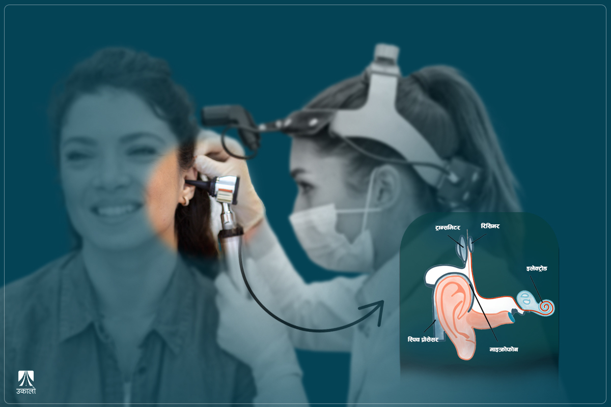 सुन्न नसक्नेका लागि ‘वरदान’ बनेको उपचार प्रविधिः कक्लिअर इम्प्लान्ट